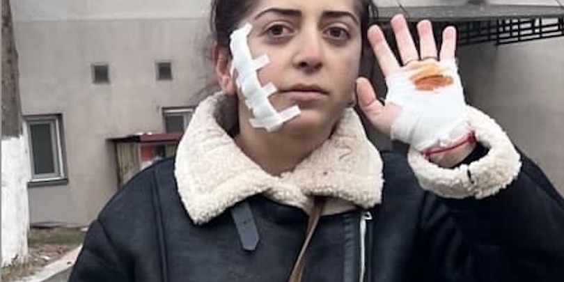 ფიქრია ეპიტაშვილი